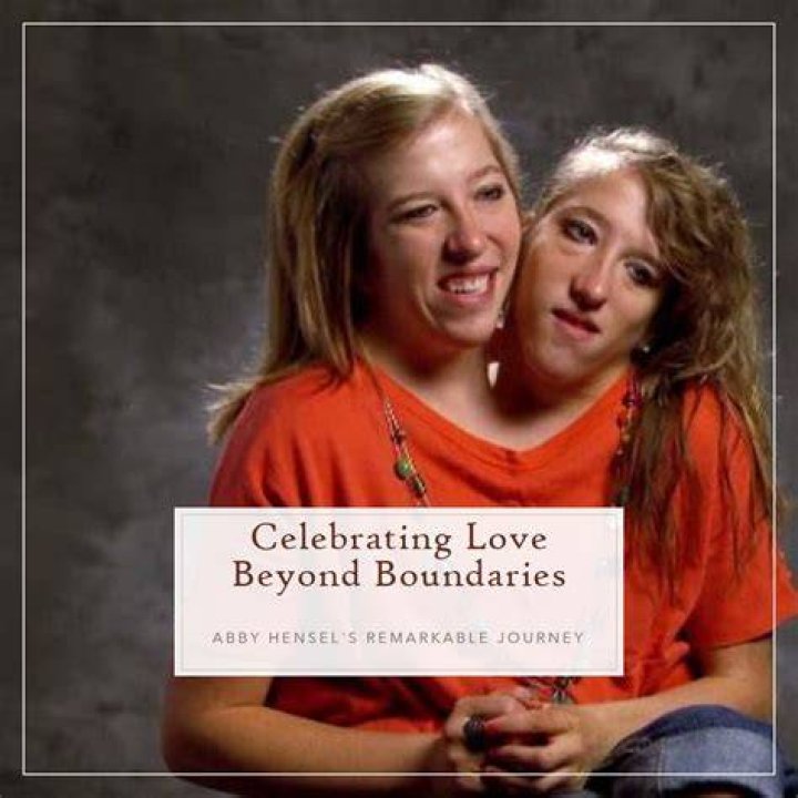 Abby And Brittany Hensel's Remarkable Journey