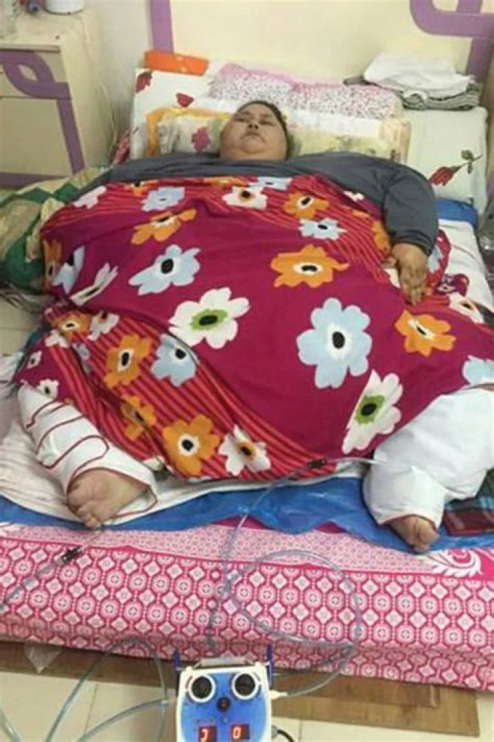 Former fattest woman in the world's incredible forty stone weight loss