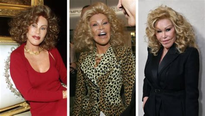 The Unbelievable Story Of Jocelyn Wildenstein: From Beauty To Controversy
