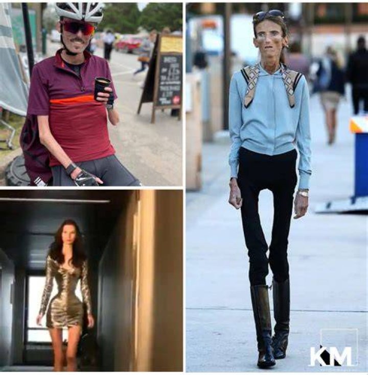 The World's Skinniest Woman: A Remarkable Journey